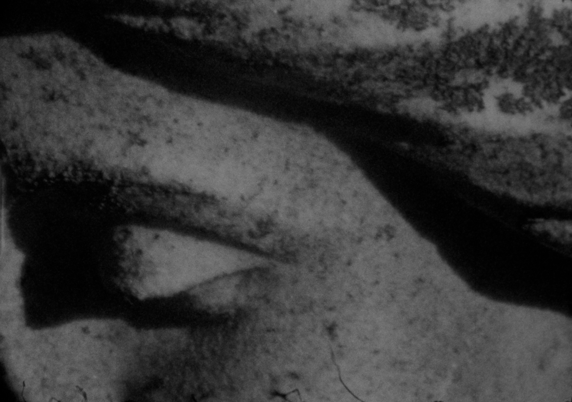 stone eye